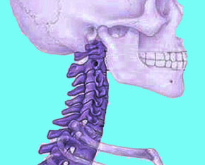 cervical-spondylitis-51 - Neck Pain