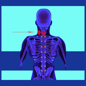 Neck Pain from a Tumor