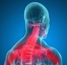 neck-pain-symptoms-51 - Neck Pain