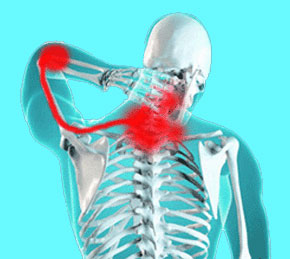 pinched-nerve-neck-pain-51 - Neck Pain